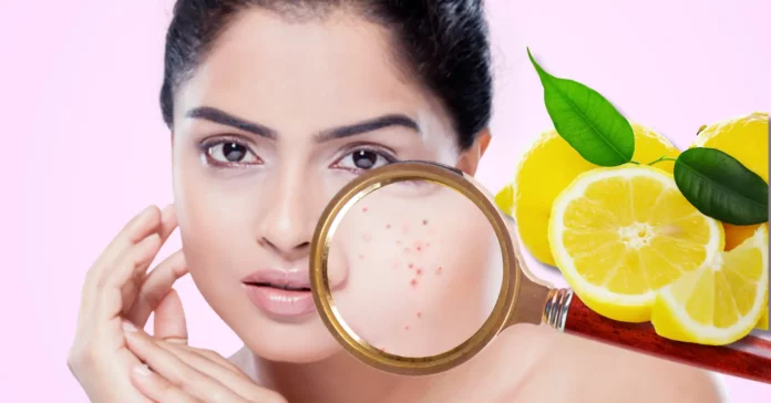 wellhealthorganic.com : remove dark spots on face tang - lemon juice